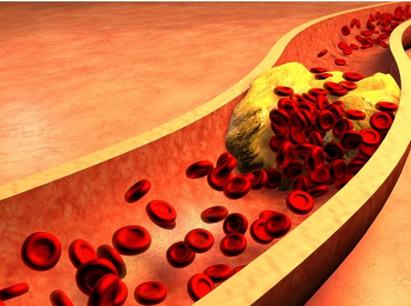 Xolesterin nədir? Xolesterin nədir?